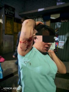 0E5ED1EE-6B19-40C4-8FEF-E1E34FCDB86C-225x300 VIDEO: Hombre ataca con machete a su familia en La Magdalena Contreras