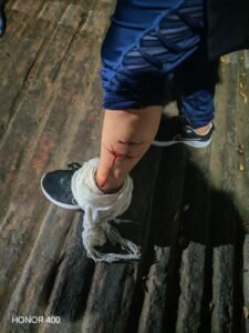 IMG_3435-225x300 VIDEO: Hombre ataca con machete a su familia en La Magdalena Contreras